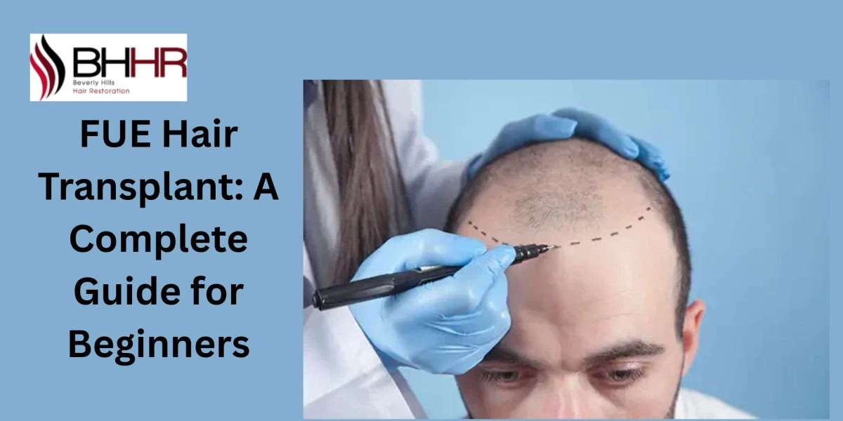 FUE Hair Transplant: A Complete Guide for Beginners