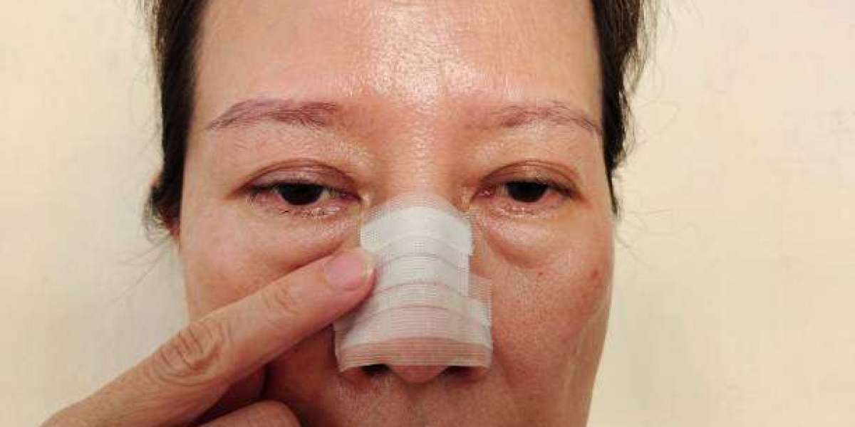 Hiko Nose Lift Cost for Men and Women in Riyadh