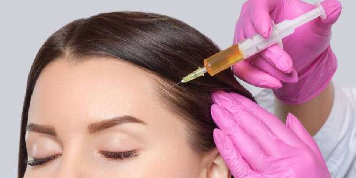 How PRP Promotes Hair Regrowth in Riyadh