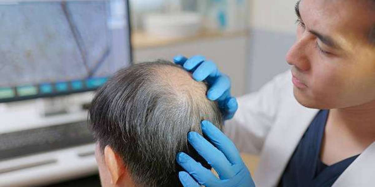 GFC Hair Treatment Before and After Results in Riyadh