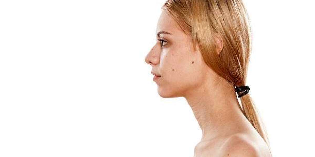 Benefits of Removing a Buffalo Hump in Riyadh